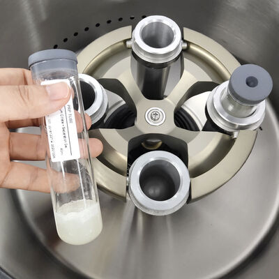 PRP-Zentrifuge mit 5000 U/min Maximalgeschwindigkeit, 3555 xg RCF und LCD-Anzeige für Laboranwendungen
