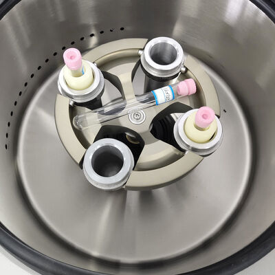 PRP-Zentrifuge mit 5000 U/min Maximalgeschwindigkeit, 3555 xg RCF und LCD-Anzeige für Laboranwendungen